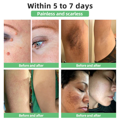 💖✨Ourlyard® 3X Concentrated, 100% Pure Castor Oil – Relieves Dry, Flaky, Itchy Skin, Seborrheic Keratosis, and Eczema