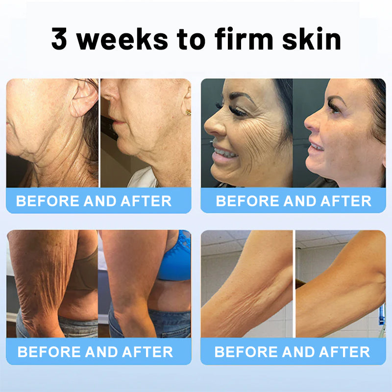 💖✨Flysmus™ Collagen Peptides  FIRMING SERUM STICK
