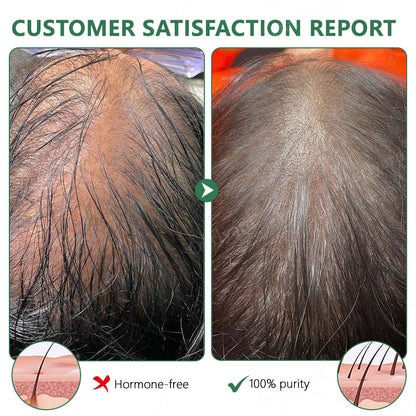 💖💖Ourlyard® 3X Concentrated Castor Oil – Australian Certified Organic, 100% Pure & Cold Pressed. Boosts Hair Growth for Thicker, Fuller Hair, Lashes & Brows.