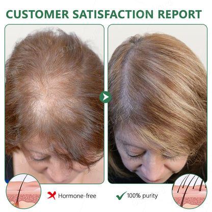 💖💖Ourlyard® 3X Concentrated Castor Oil – Australian Certified Organic, 100% Pure & Cold Pressed. Boosts Hair Growth for Thicker, Fuller Hair, Lashes & Brows.