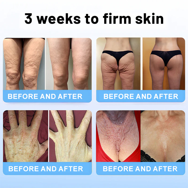 💖✨Flysmus™ Collagen Peptides  FIRMING SERUM STICK