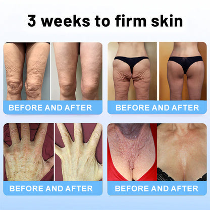 💖✨Flysmus™ Collagen Peptides  FIRMING SERUM STICK